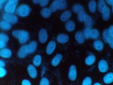 Figure 1: Mycoplasma positive sample